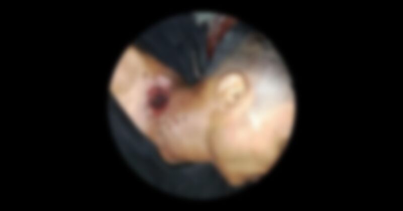 আশুলিয়ায় গুলিবিদ্ধ যুবকের মরদেহ উদ্ধার